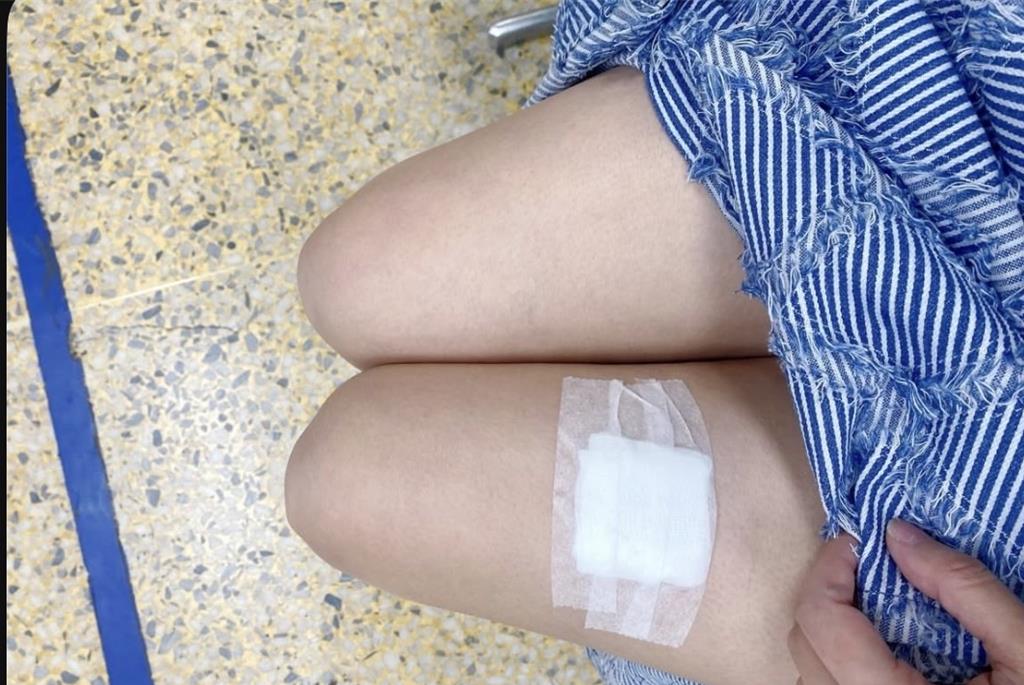 宜市某國小女老師被學生扔鉛筆盒受傷　她心寒：10多年首遭暴力對待